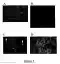 Fig. 02 - Differentiation of brain tissue