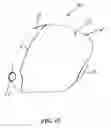 Fig. 11 - Golf club head