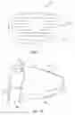 Fig. 12 - Golf club head
