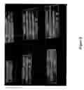 Fig. 09 - Method of treating soild tumors and leukemias using combination therapy of vitamin D and anti-metabolic nucleoside analogs