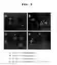 Fig. 04 - Visual function disorder improving agents