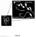 Fig. 07 - Cupredoxin derived transport agents and methods of use thereof