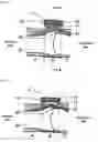 Fig. 02 - Blood pressure meter cuff