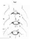 Fig. 09 - Play-in-water trunks type diaper