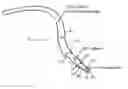 Fig. 01 - Retrograde perfusion of tumor sites