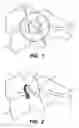 Fig. 02 - Inter-cervical facet implant with locking screw and method
