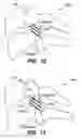 Fig. 08 - Inter-cervical facet implant with locking screw and method
