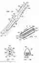 Fig. 07 - Vertebral stabilization assembly and method