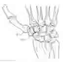 Fig. 01 - Implant for reconstruction of joints