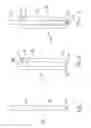 Fig. 02 - Screw locking systems for bone plates