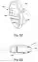 Fig. 06 - Bone anchor implantation device