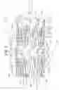 Fig. 02 - Stent