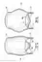 Fig. 02 - Shock dampening biocompatible valve
