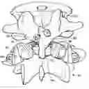 Fig. 01 - Prostheses, Tools And Methods For Replacement Of Natural Facet Joints With Artificial Facet Joint Surfaces