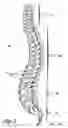 Fig. 02 - Prostheses, Tools And Methods For Replacement Of Natural Facet Joints With Artificial Facet Joint Surfaces