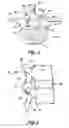 Fig. 03 - Prostheses, Tools And Methods For Replacement Of Natural Facet Joints With Artificial Facet Joint Surfaces
