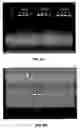 Fig. 06 - Nucleic acids encoding a galacturonosyl tranferase enzyme (GALAT1) from 