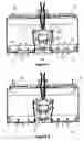 Fig. 06 - Underwater sediment management