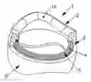 Fig. 01 - Ring having two parts that can be displaced relative to one another