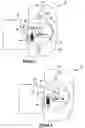 Fig. 02 - Locking device and method for unlocking the locking device