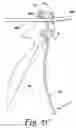 Fig. 09 - Instrument for bending spinal rods used in a spinal fixation system