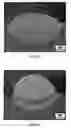 Fig. 11 - Consumable electrode arc welding