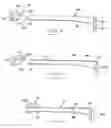 Fig. 05 - Cabinet latch