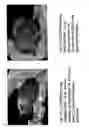 Fig. 02 - Stimulation of hair regrowth