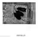 Fig. 03 - Stimulation of hair regrowth