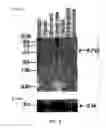 Fig. 04 - Erythrocyte differentiation factor, gene encoding same, and methods of use thereof
