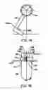 Fig. 08 - High voltage connection for vacuum electron device