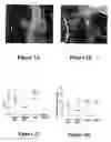 Fig. 03 - Method of treating an autoimmune disease