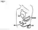Fig. 02 - Artificial myocardial device assisting motion of heart