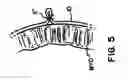 Fig. 06 - Delivery of cardiac constraint jacket