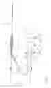 Fig. 02 - Surgical device for removing tissue cells from a biological structure