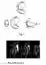 Fig. 02 - Methods and apparatus for vision correction