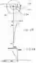 Fig. 07 - Thermal mapping of a cryoablation volume, for image-guided cryosurgery