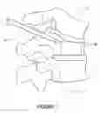 Fig. 02 - Three-dimensional implantable bone support