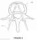 Fig. 06 - Three-dimensional implantable bone support