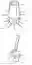 Fig. 12 - Cartridge for vascular device