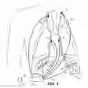 Fig. 02 - Device and method for biasing lung volume