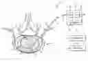 Fig. 01 - Combination electrical stimulating and infusion medical device
