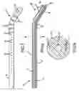 Fig. 04 - Combination electrical stimulating and infusion medical device