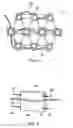 Fig. 05 - Delivery device for stimulating the sympathetic nerve chain