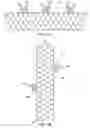Fig. 02 - Apparatus and method for deploying an implantable device within the body