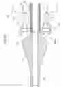 Fig. 16 - Apparatus and method for deploying an implantable device within the body