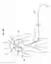 Fig. 19 - Apparatus and method for deploying an implantable device within the body