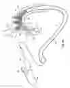 Fig. 22 - Apparatus and method for deploying an implantable device within the body