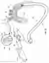 Fig. 24 - Apparatus and method for deploying an implantable device within the body