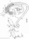 Fig. 25 - Apparatus and method for deploying an implantable device within the body